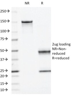 Moesin Antibody (MSN/493), Novus Biologicals 0.2mg; Unlabeled:Antibodies,